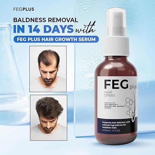 FEGPLUS Minoxidil Beard & Hair Growth Serum Kit with Roller for Unisex Hair Loss Treatment, Rosemary Oil Hair Growth Booster (50ml)